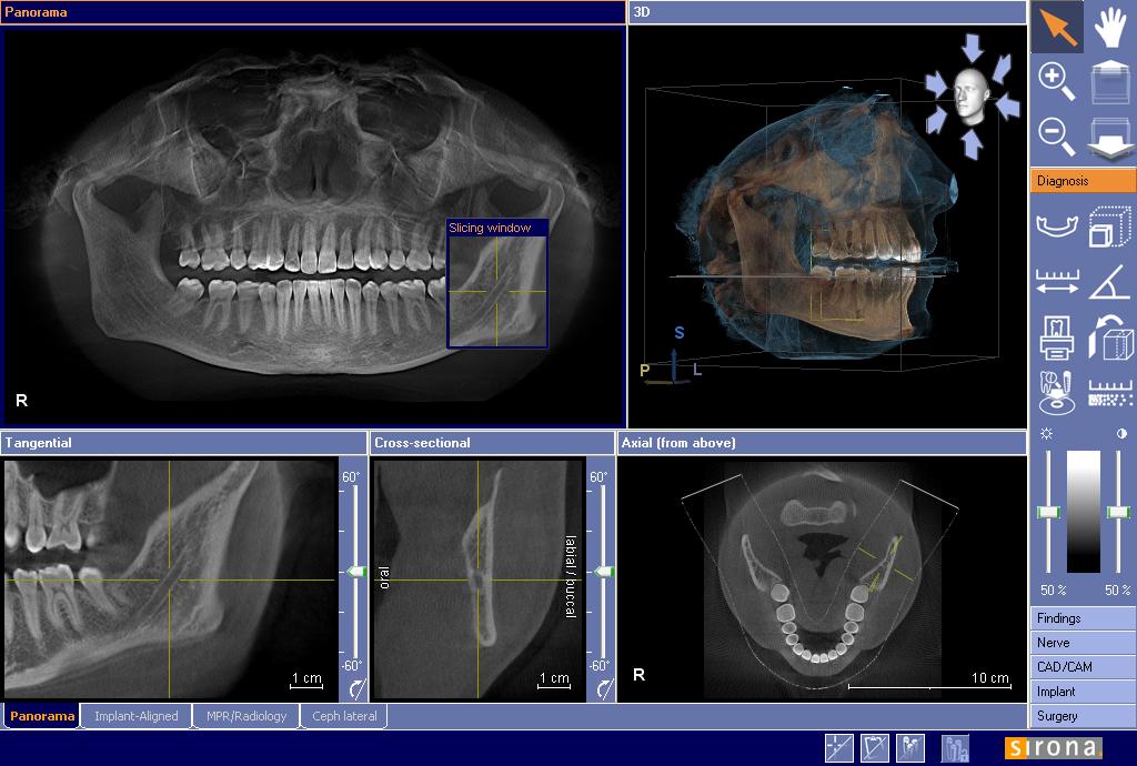 CBCT dental imaging market