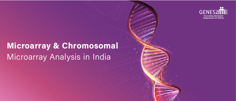 Chromosomal Microarray Analysis
