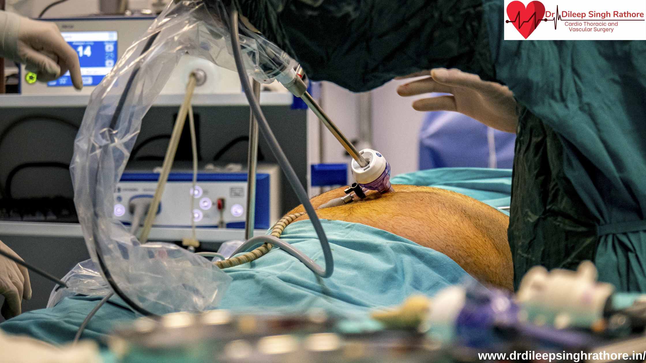Top Bypass Surgeon In Bhopal: Your Ultimate Guide To Heart Health