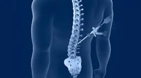 Minimally Invasive Spine Surgery India Expert Care and Quick Recovery