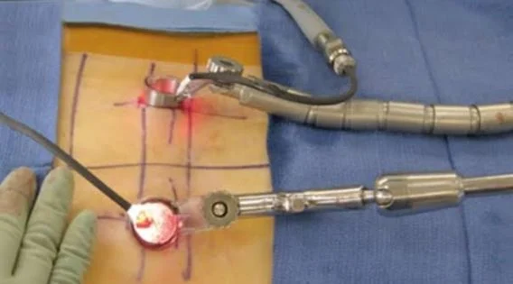Minimally Invasive Spine Surgery India: Meet the Top Spine Surgeon in Kolkata
