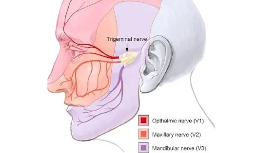 Best Trigeminal Neuralgia Specialist in India: Tips for Living a Normal Life with Trigeminal Neuralgia