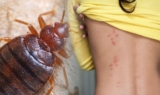 Things You Should Know About Bed Bugs and Tips to Get Rid of Them