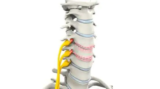 Best Cervical Spine Surgeon in India – Top Neurosurgeon’s Insights