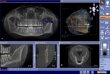CBCT Dental Imaging Market Global Industry Analysis New Development and Opportunities to 2023