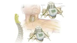 Cervical Spine Neurosurgery in Kolkata: Advanced Solutions for Neck Pain