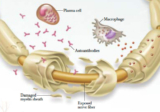 Chronic Inflammatory Demyelinating Polyneuropathy (CIDP) Market Trends and Technology Report 2019