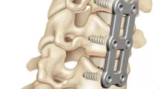 Contact Top Neuro Spine Surgeon in India: Meet the Best Cervical Spine Surgeon