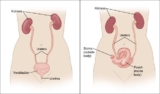 Cystectomy Market Growth, Advancements, Industry Opportunities and Forecast to 2023