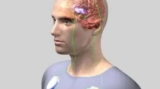 DBS Treatment in India: Transforming Lives with Brain Pacemaker