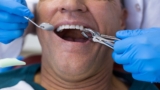How to Stop Emergency Bleeding after Tooth Extraction