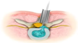 How Minimal Access Spine Surgery in Kolkata Can Improve Spinal Health