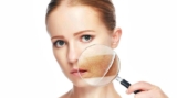 Hyperpigmentation Disorders Treatment Market Analysis and growth research Report 2019