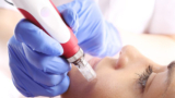 Medical Aesthetics Market 2019 Growth Drivers, Restraints and Opportunities to 2023