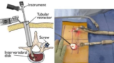 Meet a Minimally Invasive Spine Surgeon in India: Top Spine Surgeon in Kolkata