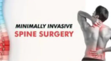 Minimally Invasive Spine Surgery Kolkata: Consult Top Spine Surgeon India