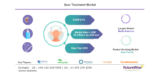 Scar Treatment Market Global Trends, Market Share, Industry Size, Growth, Opportunities, and Market Forecast 2019 to 2026