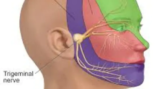 The Role of Surgery in Treating Trigeminal Neuralgia: Expert Neurosurgeon’s Opinion