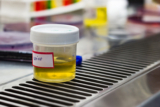 Urine Cytology Market Growth According to Evolving Technology and Trends to 2023