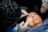 How to Choose the Right Plastic Surgery in Mission Viejo, CA: A Friendly Guide