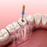 Trinity Dental @ Alkimos Delivers the Best Dental Services