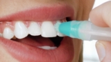 Surprising Facts about Teeth Whitening