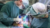 Heart Valve Surgery: Repair And Replacement Procedures